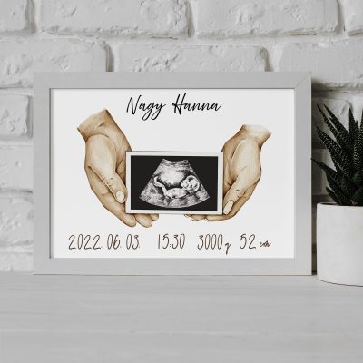 Születési adatok ultrahang képpel poszter